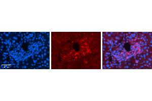 Rabbit Anti-ALDOA Antibody   Formalin Fixed Paraffin Embedded Tissue: Human Liver Tissue Observed Staining: Cytoplasm in bile ductule Primary Antibody Concentration: N/A Other Working Concentrations: 1:600 Secondary Antibody: Donkey anti-Rabbit-Cy3 Secondary Antibody Concentration: 1:200 Magnification: 20X Exposure Time: 0.