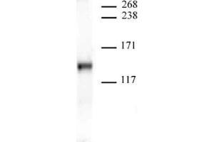 JMJD2A antibody (mAb) tested by Western blot. (KDM4A anticorps  (AA 586-674))
