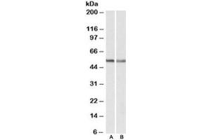 Western blot testing of human A549 [A] and mouse NIH3T3 [B] lysates with CB1 antibody at 0. (CNR1 anticorps)