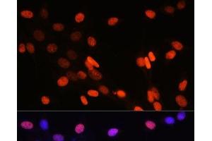Immunofluorescence analysis of NIH-3T3 cells using DiMethyl-Histone H3-K14 Polyclonal Antibody at dilution of 1:100 (40x lens).