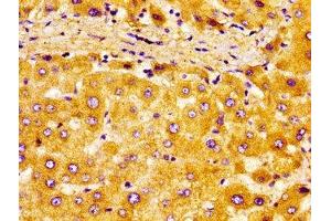 Immunohistochemistry of paraffin-embedded human liver tissue using ABIN7161906 at dilution of 1:100