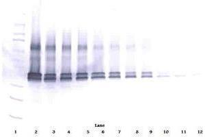 Image no. 4 for anti-Vascular Endothelial Growth Factor A (VEGFA) antibody (ABIN465273)