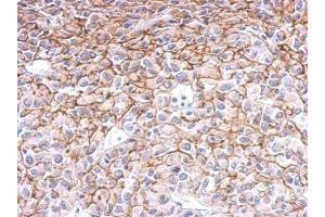 IHC-P Image Endothelin B Receptor antibody detects Ednrb protein at membrane on U87 xenograft by immunohistochemical analysis.