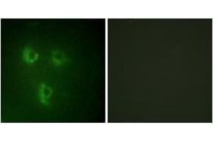 Immunofluorescence analysis of HuvEc cells, using TMEPA Antibody. (TMEPA (AA 101-150) anticorps)