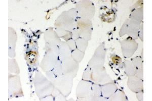 Anti- BAK Picoband antibody, IHC(P) IHC(P): Mouse Skeletal Muscle Tissue (BAK1 anticorps  (AA 22-211))