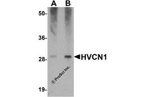 Western Blotting (WB) image for anti-Hydrogen Voltage-Gated Channel 1 (HVCN1) (C-Term) antibody (ABIN1030426)