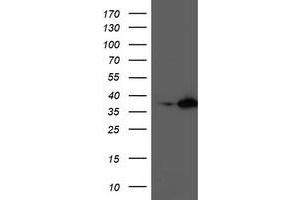 Western Blotting (WB) image for anti-Nudix (Nucleoside Diphosphate Linked Moiety X)-Type Motif 18 (NUDT18) antibody (ABIN1499860) (NUDT18 anticorps)