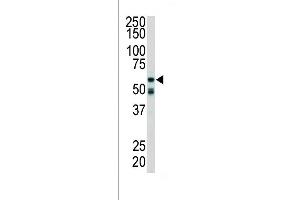 Western blot analysis of anti-RIPK2 Pab (ABIN392274 and ABIN2841944) in mouse cerebellum tissue lysate.