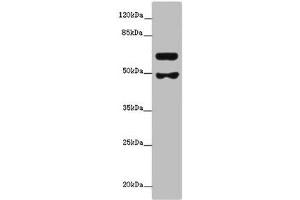 Western blot All lanes: GALNT16 antibody at 12 μg/mL + Mouse kidney tissue Secondary Goat polyclonal to rabbit at 1/10000 dilution Predicted band size: 64, 61 kDa Observed band size: 64, 49 kDa (WBSCR17 anticorps  (AA 301-558))