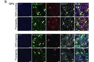 Cell-type identity of GPe projections to striatal ChAT and PV interneurons.