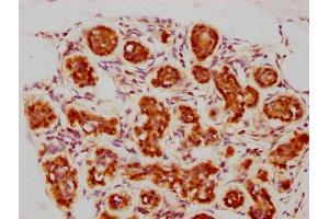 IHC image of ABIN7127361 diluted at 1:73.