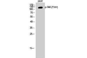 Western Blotting (WB) image for anti-PTK2 Protein tyrosine Kinase 2 (PTK2) (pTyr397) antibody (ABIN3182621) (FAK anticorps  (pTyr397))