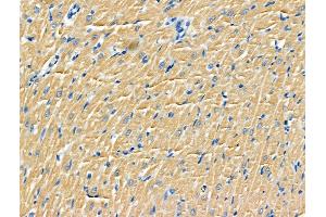 ABIN6264860 and ABIN6266755 at 1/100 staining Rat heart tissue by IHC-P. (RPS9 anticorps  (Internal Region))