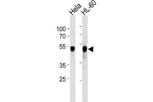 Western Blotting (WB) image for anti-Vaccinia Related Kinase 1 (VRK1) antibody (ABIN2905796) (VRK1 anticorps)