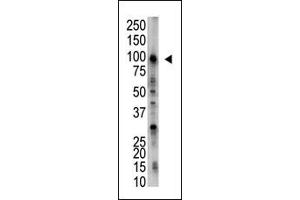 Image no. 1 for anti-Ubiquitin Specific Peptidase 5 (USP5) (C-Term) antibody (ABIN357529) (USP5 anticorps  (C-Term))