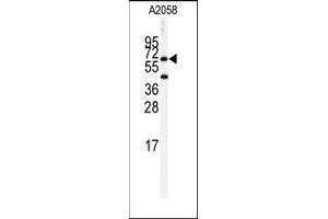 Image no. 1 for anti-Butyrylcholinesterase (BCHE) (Middle Region) antibody (ABIN360174) (Butyrylcholinesterase anticorps  (Middle Region))