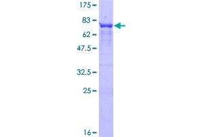 Image no. 1 for Protein Phosphatase 2, Regulatory Subunit B', epsilon Isoform (PPP2R5E) (AA 1-467) protein (GST tag) (ABIN1316062)