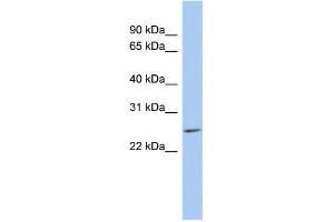 WB Suggested Anti-LYPD5 Antibody Titration: 0. (LYPD5 anticorps  (N-Term))