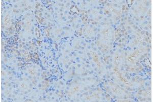 ABIN6279381 at 1/100 staining Mouse kidney tissue by IHC-P.