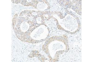 Immunohistochemistry (IHC) image for anti-KIAA1524 (KIAA1524) (AA 853-903) antibody (ABIN7453880) (KIAA1524 anticorps  (AA 853-903))