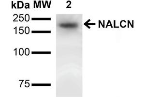 Western Blot analysis of Rat Brain showing detection of ~200 kDa NALCN protein using Mouse Anti-NALCN Monoclonal Antibody, Clone S187-7 . (NALCN anticorps  (AA 1659-1738) (Atto 488))