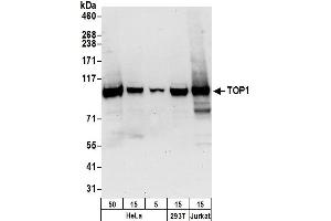 Western Blotting (WB) image for anti-Topoisomerase (DNA) I (TOP1) (AA 715-765) antibody (ABIN7450832) (Topoisomerase I anticorps  (AA 715-765))