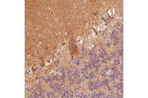 Immunohistochemical staining (Formalin-fixed paraffin-embedded sections) of human cerebellum with FABP7 monoclonal antibody, clone CL0236  shows positivity in the molecular cell layer and Purkinje cells. (FABP7 anticorps)