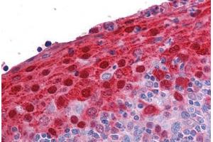 Human Tonsil: Formalin-Fixed, Paraffin-Embedded (FFPE) (S100A7 anticorps  (AA 18-30))