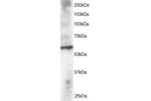 Image no. 1 for anti-Dual Specificity Phosphatase 8 (DUSP8) (N-Term) antibody (ABIN374169) (DUSP8 anticorps  (N-Term))