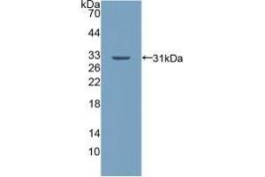Western blot analysis of recombinant Human PALLD. (PALLD anticorps  (AA 1137-1383))