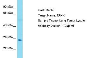 Host: Rabbit Target Name: TANK Sample Tissue: Human Lung Tumor Antibody Dilution: 1ug/ml (TANK anticorps  (N-Term))