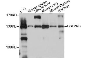 Western blot analysis of extracts of various cell lines, using CSF2RB antibody.