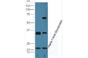 Lane 1: Human HepG2 cell lysates Lane 2: Mouse lung lysates probed with Anti-Alpha 1 Acid Glycoprotein Polyclonal Antibody, Unconjugated  at 1:5000 90min in 37˚C. (ORM1 anticorps  (AA 101-201))