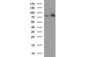 Western Blotting (WB) image for anti-Hydroxysteroid (17-Beta) Dehydrogenase 4 (HSD17B4) antibody (ABIN2715561) (HSD17B4 anticorps)