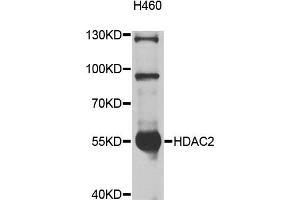 Western blot analysis of extracts of H460 cells, using HDAC2 antibody (ABIN5997878) at 1/1000 dilution. (HDAC2 anticorps)