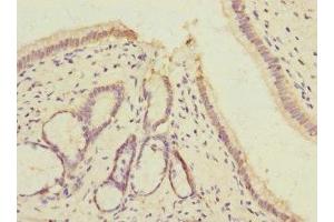 Immunohistochemistry of paraffin-embedded human pancreatic tissue using ABIN7175348 at dilution of 1:100