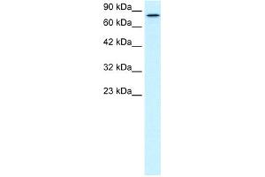WB Suggested Anti-KIF3B Antibody Titration:  0. (KIF3B anticorps  (C-Term))
