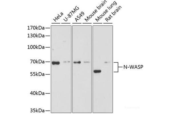 Neural Wiskott-Aldrich syndrome protein (WASL) anticorps