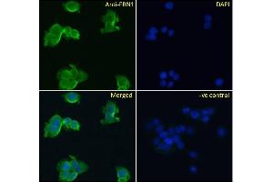 (ABIN570798) Immunofluorescence analysis of paraformaldehyde fixed A431 cells, permeabilized with 0.