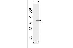 Western blot analysis of OLR1 (arrow) using rabbit polyclonal OLR1 Antibody (Center) (ABIN652795 and ABIN2842521). (OLR1 anticorps  (AA 64-92))