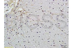 Formalin-fixed and paraffin embedded rat brain labeled with Anti-Claudin 5 Polyclonal Antibody, Unconjugated (ABIN673869) followed by conjugation to the secondary antibody and DAB staining (Claudin 5 anticorps)