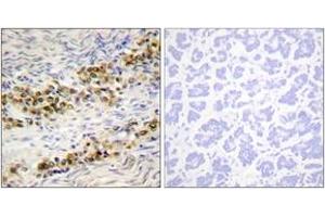 Immunohistochemistry analysis of paraffin-embedded human ovary, using Akt (Phospho-Ser246) Antibody. (AKT1 anticorps  (pSer246))