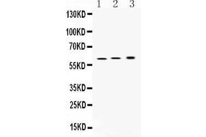 Western blot analysis of ATP4B expression in rat stomach extract ( Lane 1), mouse stomach extract ( Lane 2) and SGC7901 whole cell lysates ( Lane 3). (ATP4b anticorps  (N-Term))