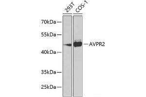 Western blot analysis of extracts of various cell lines using AVPR2 Polyclonal Antibody at dilution of 1:1000. (AVPR2 anticorps)