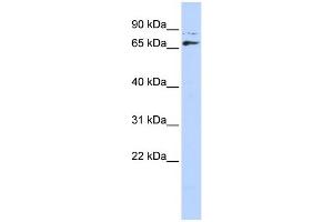 WB Suggested Anti-DLX4 Antibody Titration: 0. (DLX4 anticorps  (Middle Region))