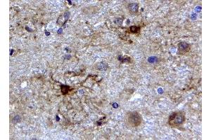 ABIN2562804 (2µg/ml) staining of paraffin embedded Human Cerebellum. (GFAP anticorps  (C-Term))