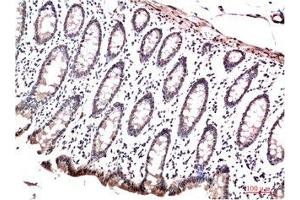 Immunohistochemical analysis of paraffin-embedded Human Colon Carcinoma Tissue using HP-1γ Mouse mAb diluted at 1:200 (CBX3 anticorps)