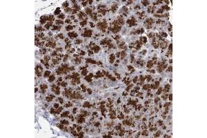 Immunohistochemical staining of human pancreas with LOC150763 polyclonal antibody  shows strong cytoplasmic positivity in exocrine glandular cells at 1:50-1:200 dilution.