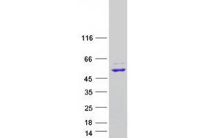 Validation with Western Blot