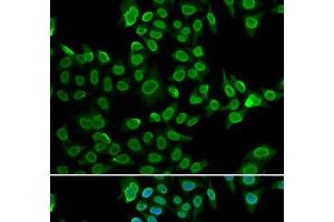 Immunofluorescence analysis of U2OS cells using LMNB2 Polyclonal Antibody